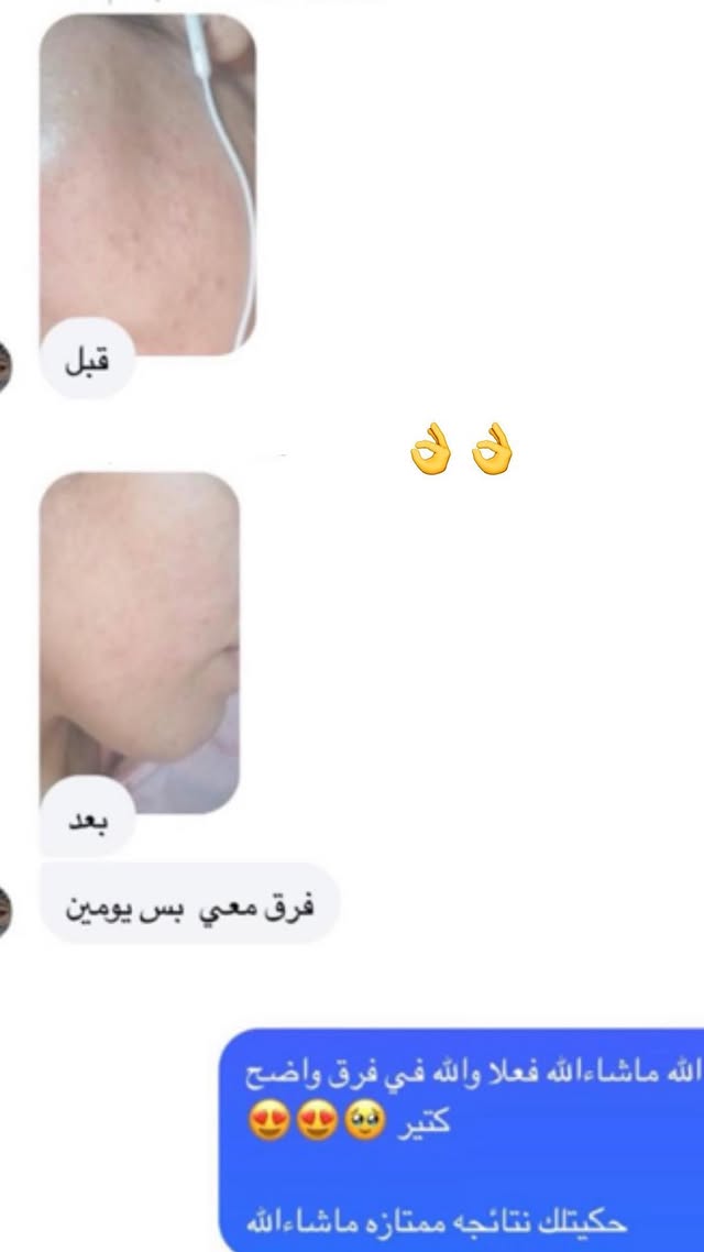 رأي عميل 5