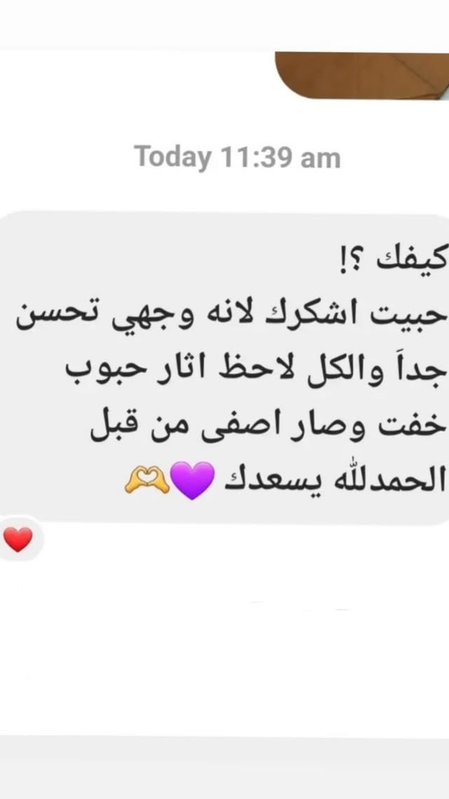 رأي عميل 8